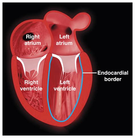 what is .lv|what is lv in cardiology.